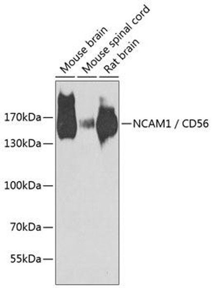 NCAM1/CD56 Rabbit Polyclonal Antibody (CAB7913)