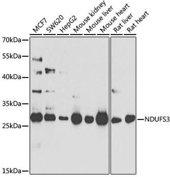 [KO Validated] NDUFS3 Rabbit Polyclonal Antibody (CAB8013)
