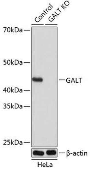 Anti-GALT Antibody (CAB19903)[KO Validated]