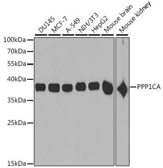 Anti-PPP1CA Antibody (CAB2184)