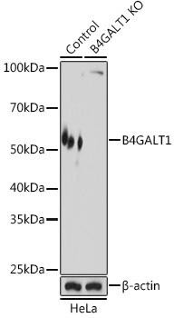 [KO Validated] B4GALT1 Rabbit Polyclonal Antibody (CAB8546)