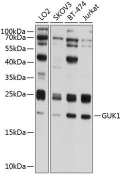 GUK1 Rabbit Polyclonal Antibody (CAB8656)