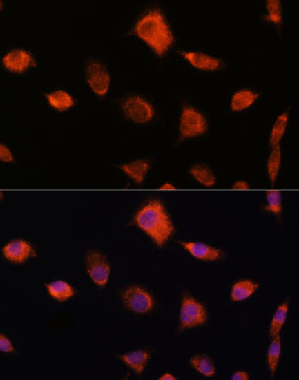 NUMB Rabbit Polyclonal Antibody (CAB9352)