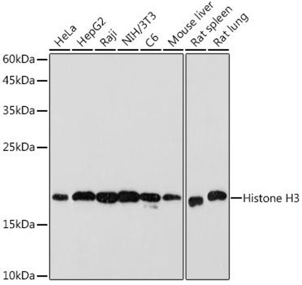 Anti-Histone H3 Antibody (CAB17562)