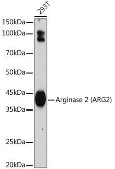 Anti-Arginase 2 (ARG2) Antibody (CAB19233)