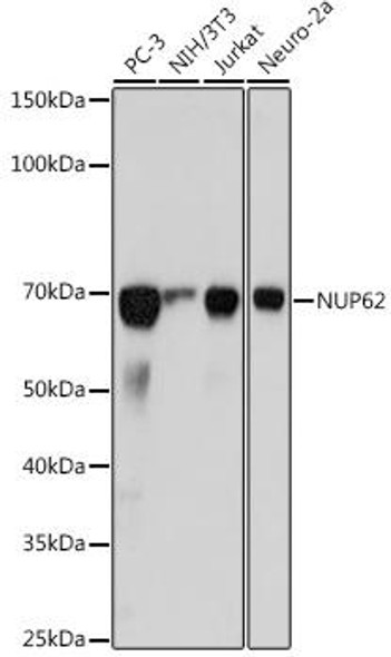 Anti-NUP62 Antibody (CAB19271)