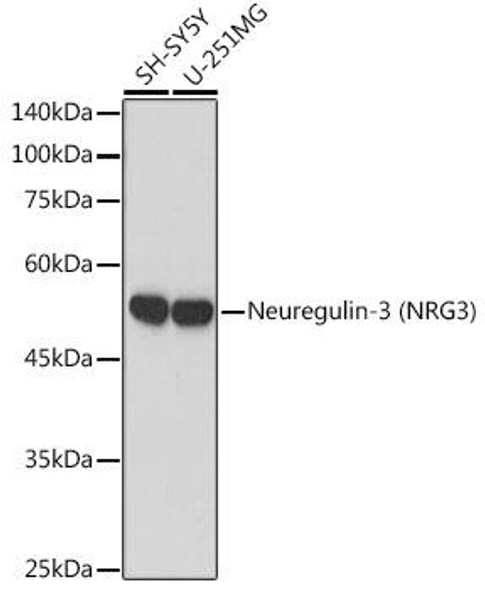 Anti-Neuregulin-3 (NRG3) Antibody (CAB19763)