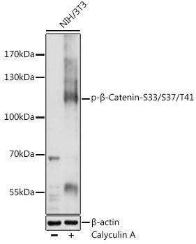 Phospho-β-Catenin-S33/S37/T41 Rabbit Polyclonal Antibody (CABP0524)