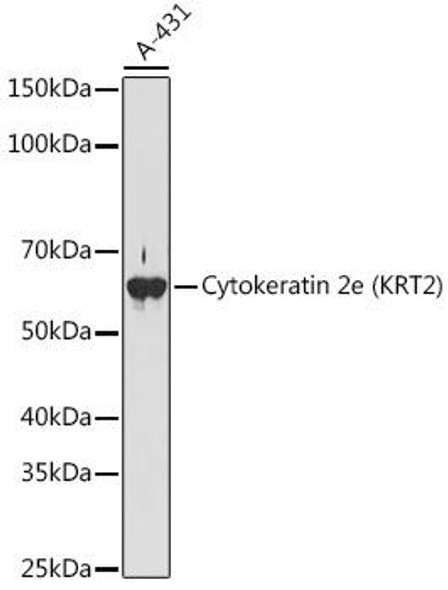 Anti-Cytokeratin 2e (KRT2) Antibody (CAB2615)