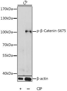 Anti-Phospho-CTNNB1-S675 pAb Antibody (CABP0795)