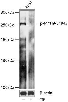 Phospho-MYH9-S1943 Rabbit Polyclonal Antibody (CABP0802)