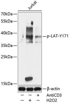 Phospho-LAT-Y171 Rabbit Polyclonal Antibody (CABP0809)