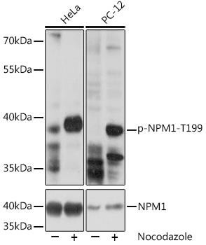 Phospho-NPM1-T199 Rabbit Polyclonal Antibody (CABP0836)