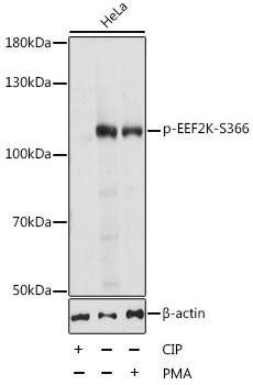 Phospho-EEF2K-S366 Rabbit Polyclonal Antibody (CABP0845)