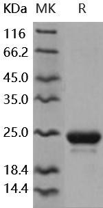 Human NGAL/Lipocalin-2 Recombinant Protein (His Tag) (Active) (RPES0089)