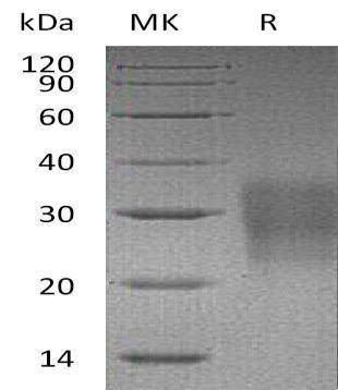 Mouse FAS/TNFRSF6 Recombinant Protein (His Tag) (Active) (RPES0092)
