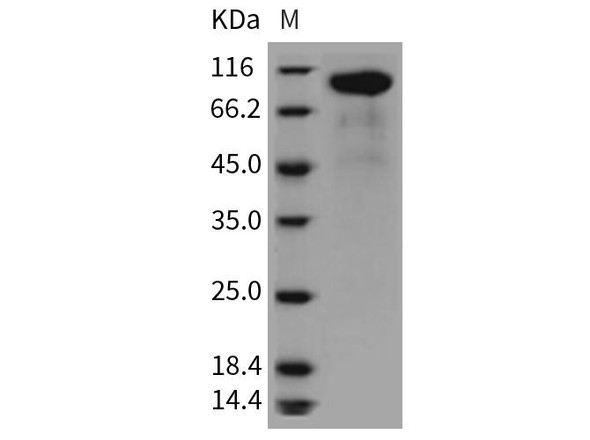 Rat HER2/ErbB2 Recombinant Protein (Active) (RPES0099)