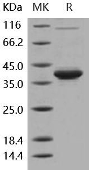 Human IL-8/CXCL8 Recombinant Protein (Fc Tag) (RPES0107)