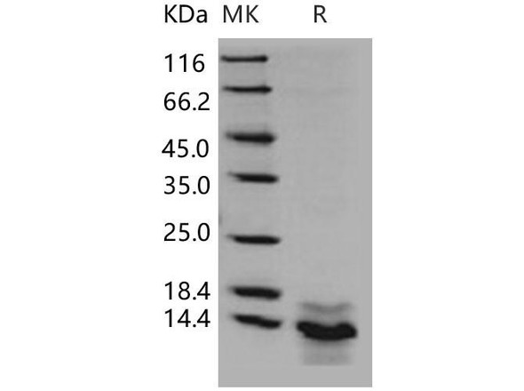 Human S100A14/S114 Recombinant Protein (His Tag) (RPES0115)
