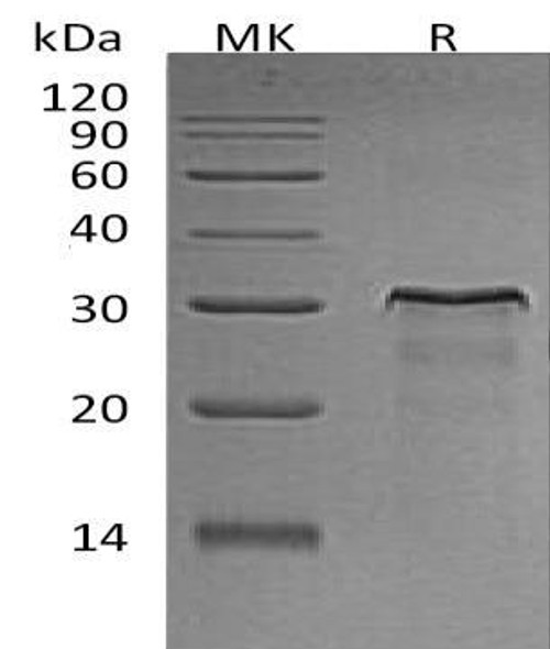 Rat HER2/ErbB2 Recombinant Protein (aa 4-656, His Tag) (RPES0121)