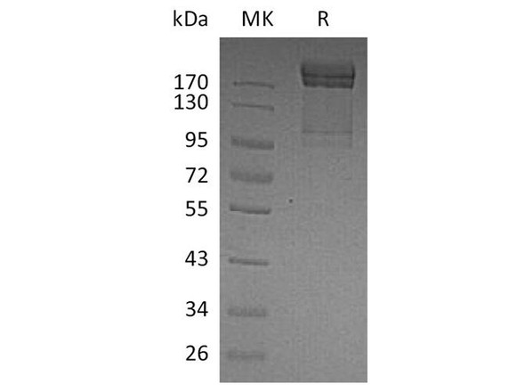 Human PSGL/CD162 Recombinant Protein (RPES0148)
