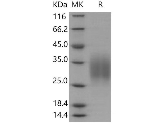 Mouse CD83/HB15 Recombinant Protein (aa 133, His Tag) (RPES0156)