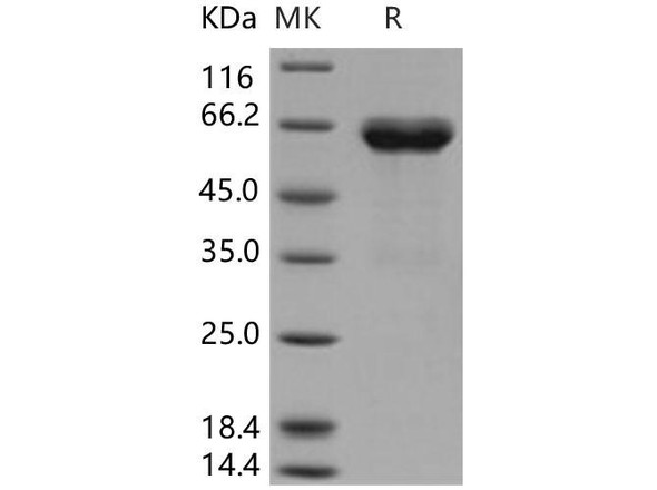 Human Ephrin-B1/EFNB1 Recombinant Protein (His & Fc Tag) (Active) (RPES0174)