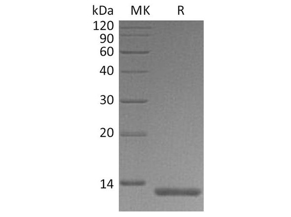 Human S100A4 Recombinant Protein (RPES0190)
