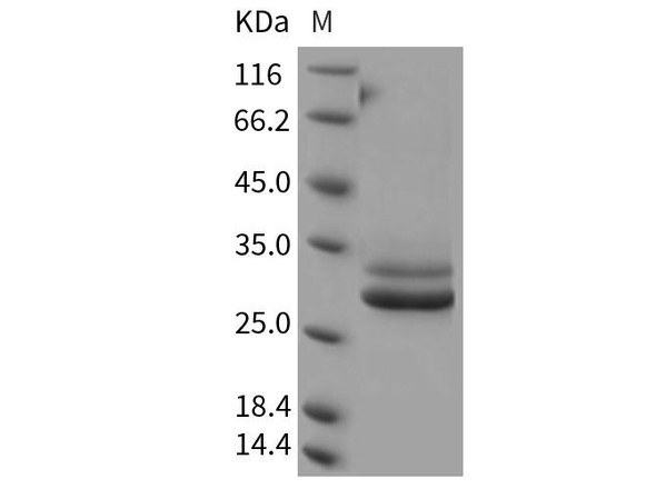 Rat JAM-A/F11R Recombinant Protein (His Tag) (RPES0196)