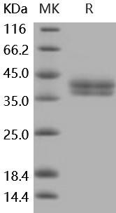 Mouse CA12 Recombinant Protein (RPES0198)