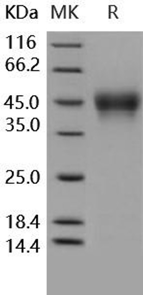 Human CD16a/FCGR3A Recombinant Protein (RPES0212)