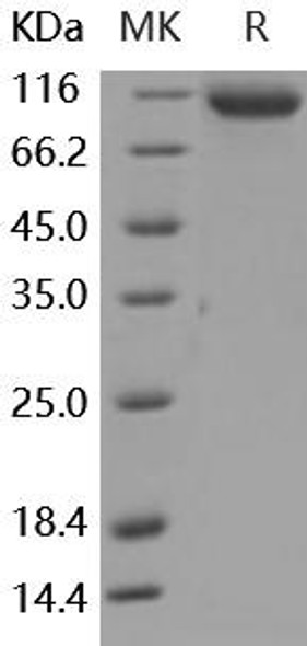 Mouse ASAH2 Recombinant Protein (RPES0274)
