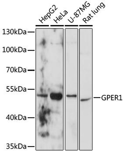 Anti-GPER1 Antibody (CAB10217)