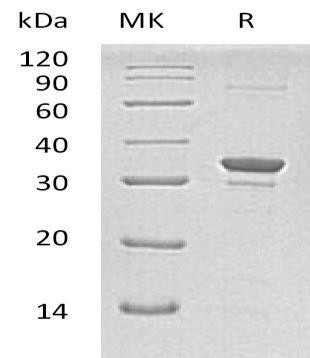 Human SULT1A2 Recombinant Protein (RPES0299)