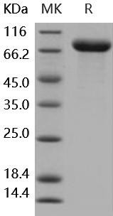 Human IL1R2/CD121b Recombinant Protein (Fc Tag) (Active) (RPES0315)
