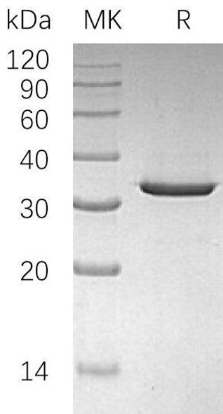 Sulfotransferase 4A1/SULT4A1 Recombinant Protein (RPES0339)