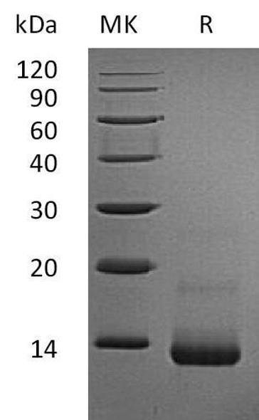 Rat CCL5/RANTES Recombinant Protein (RPES0340)