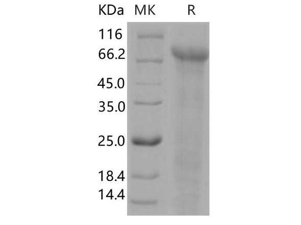 Human Jagged 1/JAG1 Recombinant Protein (RPES0405)