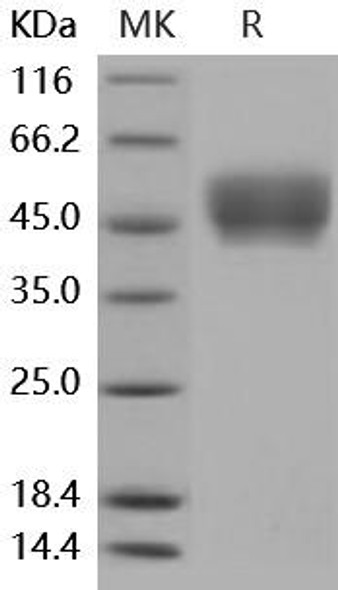 Mouse CD64/FCGR1 Recombinant Protein (RPES0410)