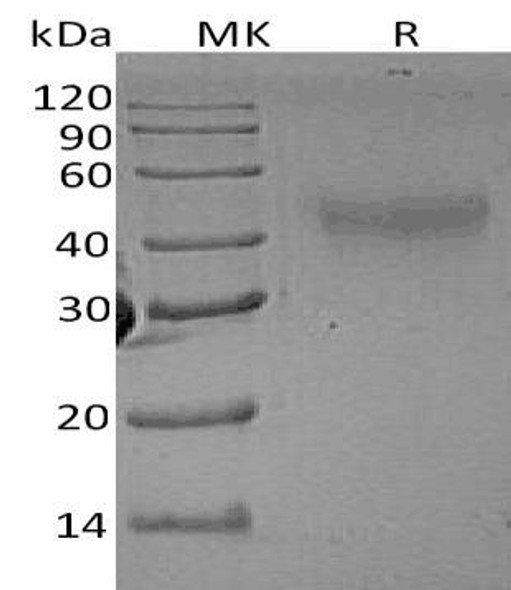Rat M-CSF/CSF1 Recombinant Protein (RPES0456)