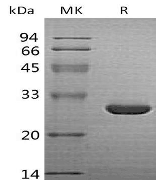 Human HO/HMOX1 Recombinant Protein (RPES0471) Human HO/HMOX1 Recombinant Protein (RPES0471)