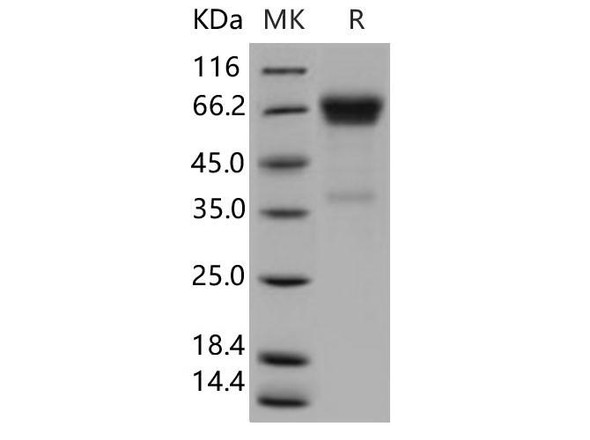 Human OLFM4 Recombinant Protein (RPES0482)