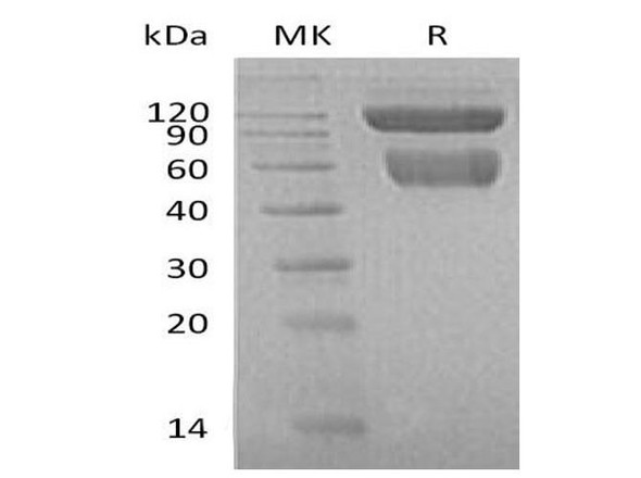 Mouse TRAIL R2/TNFRSF10B Recombinant Protein (RPES0499) Mouse TRAIL R2/TNFRSF10B Recombinant Protein (RPES0499)