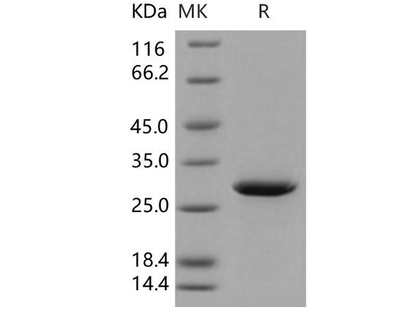 Human 14-3-3 sigma/YWHAS Recombinant Protein (RPES0522)