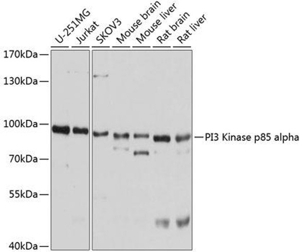 Anti-PI3 Kinase p85 alpha Antibody (CAB11177)