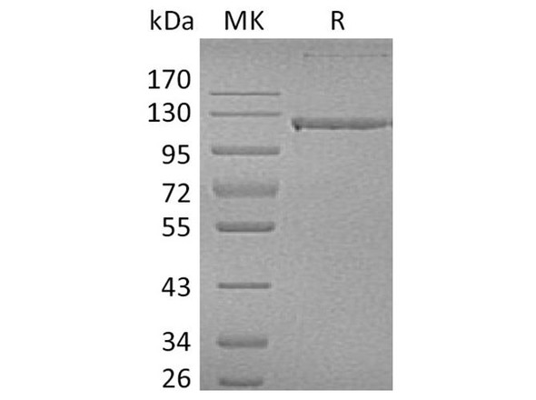 Human CD31/PECAM1 Recombinant Protein (RPES0555) Human CD31/PECAM1 Recombinant Protein (RPES0555)