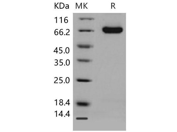 Mouse DLL4 Recombinant Protein (His Tag) (Active) (RPES0582)