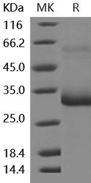 Mouse MBL2/MBL/COLEC1 Recombinant Protein (RPES0583)