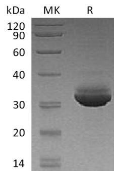 Human CELA3A Recombinant Protein (RPES0585)