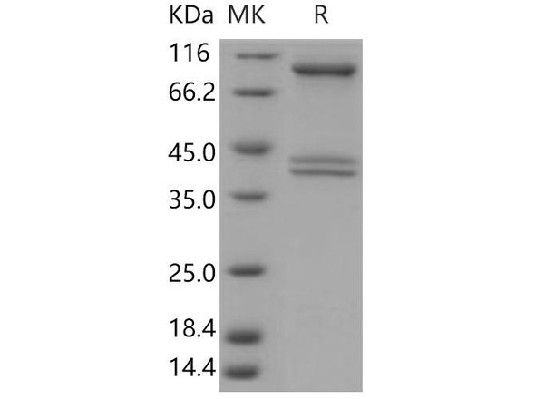 Human AMPK (G1/B1/A2) Heterotrimer Recombinant Protein (Active) (RPES0595)
